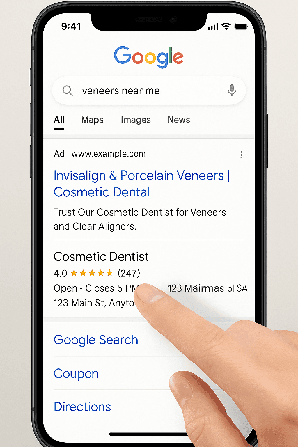 Google search results for “veneers near me” with a top ad highlighted — targeting high-intent dental patients.